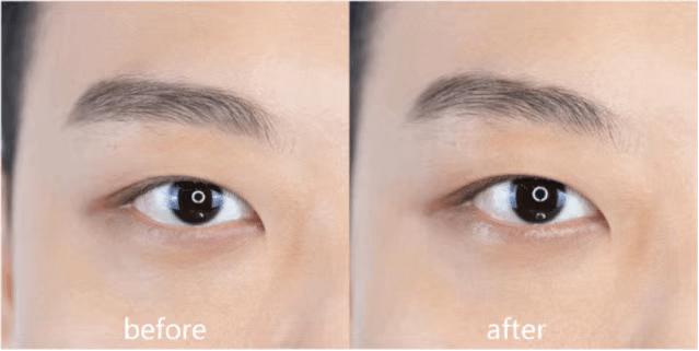 推广一个月没有任何效果,美容院脸部抗衰提拉紧致手法