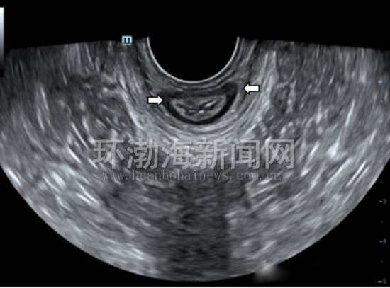 唐山工人医院免费导诊,唐山工人医院看什么病最好