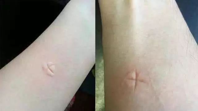 喷花露水驱蚊止痒,黄圣依代言的保湿防晒喷雾