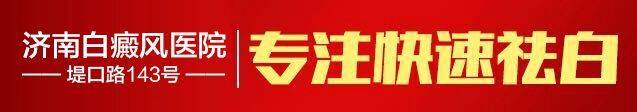 正确辨别白斑很重要,白斑病简便的鉴别方法