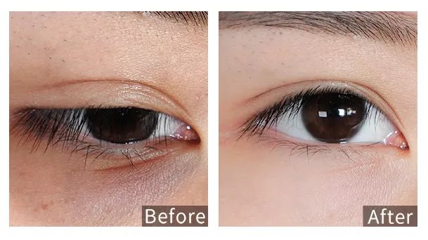 眼霜中的爱马仕!清爽不长脂肪粒,去黑眼圈效果秒2000元腊梅,亲测有效