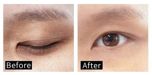 眼霜中的爱马仕!清爽不长脂肪粒,去黑眼圈效果秒2000元腊梅,亲测有效