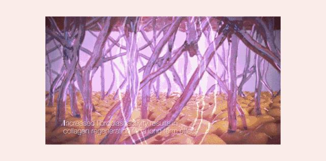 脸上长皱纹怎么办,手长皱纹怎么办