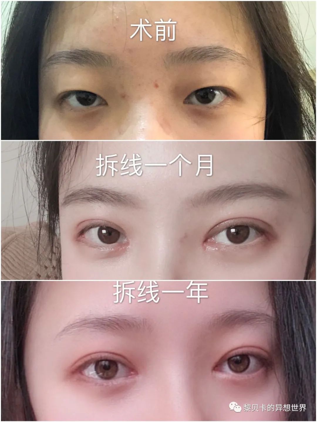 做完医美用可复美吗,你知道做完医美有多可怕