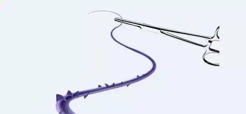 线雕抗衰老的方法,线雕改变了脸型丑死了咋办