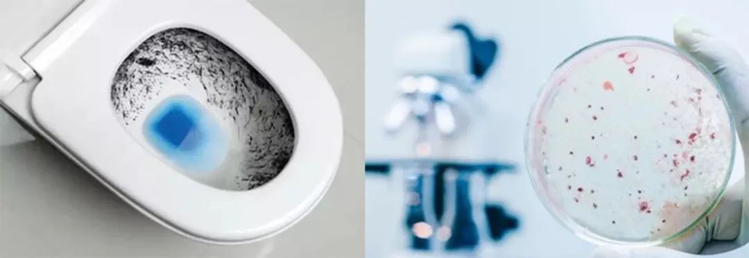 马桶又黄又脏用什么办法清洗干净,马桶又脏又臭教你一招轻松解决