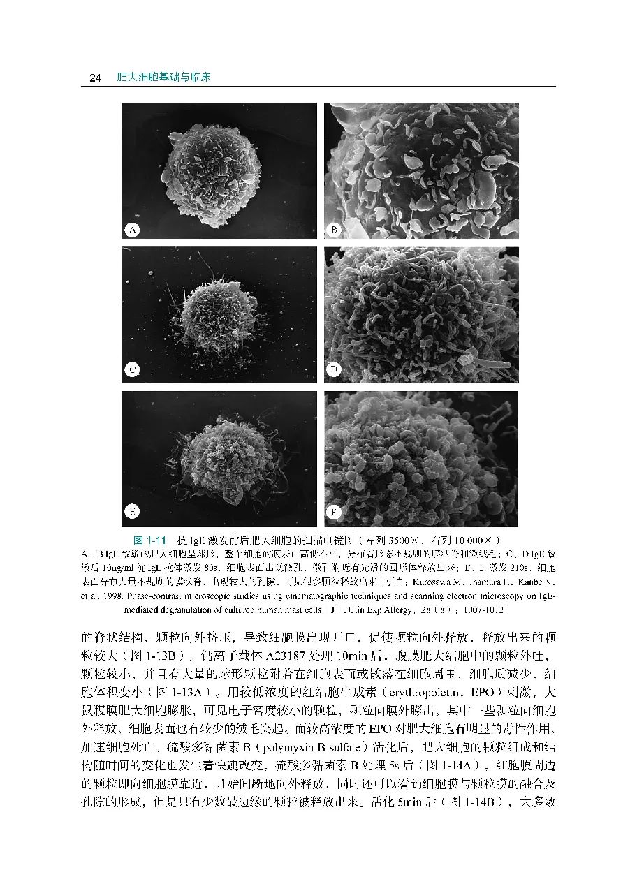 肥大细胞症,肥大细胞产生在哪