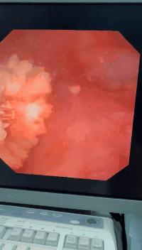 13个月宝宝反复发烧怎么回事,13个月宝宝经常发烧是什么原因