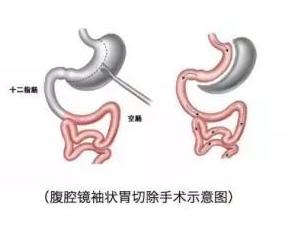 一条公式告诉你到底算不算胖,计算自己有没有偏胖的公式