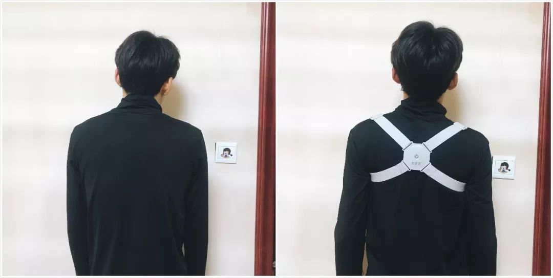 有什么方法可以改善含胸驼背,含胸驼背改善的方法