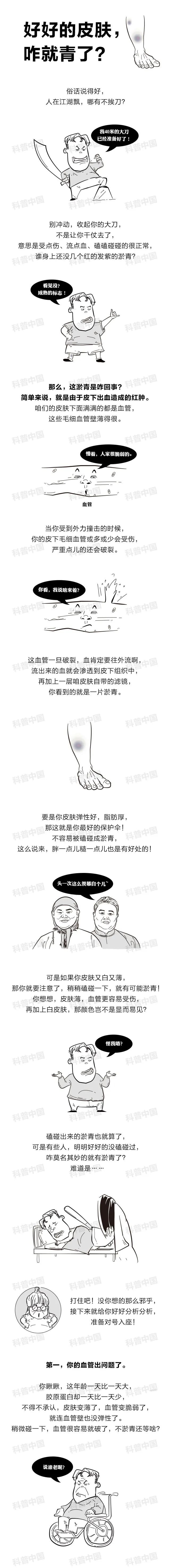 身上莫名其妙有淤青是怎么回事,身上莫名其妙有淤青的灵异说法