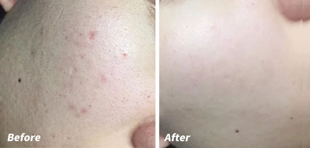 和猫咪接吻会怎么样,猫咪被亲了瞬间感觉不干净了