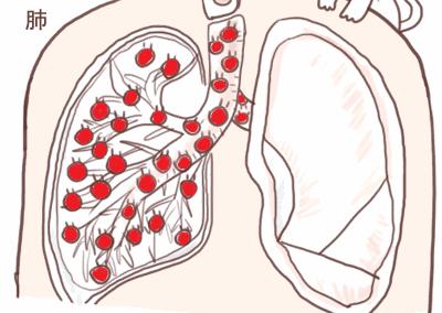 感觉嘴里有股肠胃的臭味,肠胃有一股腐臭味怎么回事
