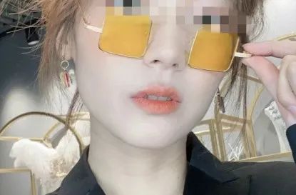 昆明龅牙矫正要多少钱,长沙轻微龅牙矫正要多少钱