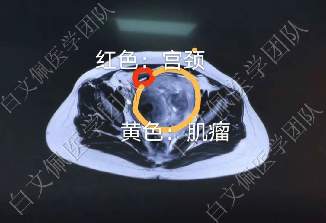 盆腔肌肉解剖结构示意图,盆腔解剖6个位置图