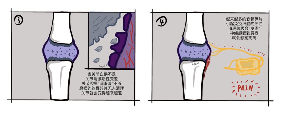 膝关节发凉吃什么药,肩膀发凉怎么保暖