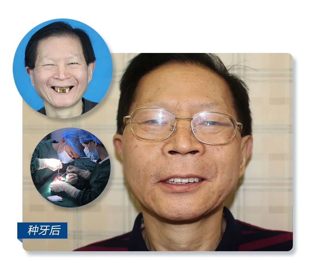 32岁男子几乎牙齿掉光,20岁小伙牙齿掉光