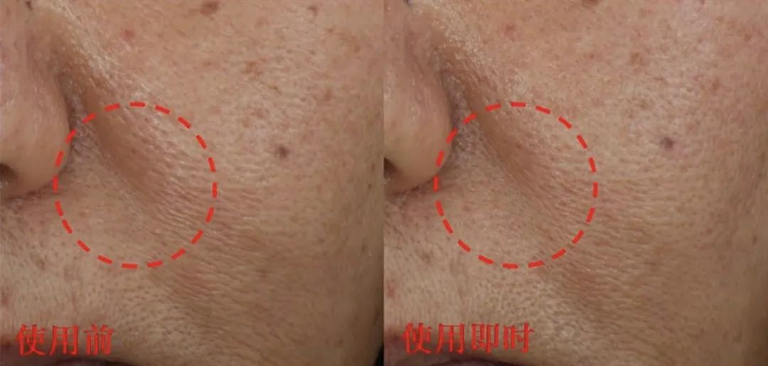 空瓶眼霜回购,无限回购的一款国货眼霜