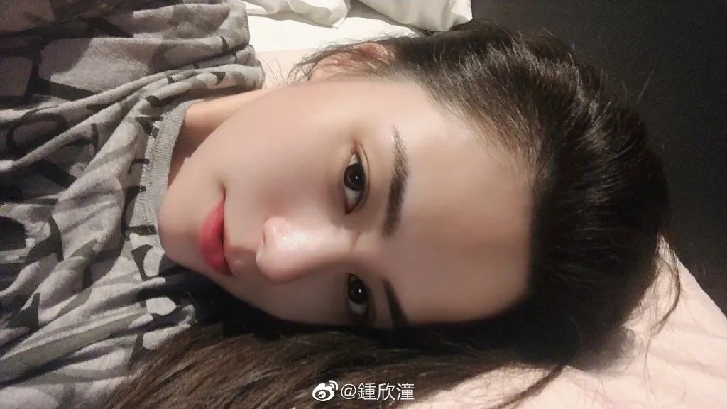 阿娇跌倒受伤,阿娇撞到额头