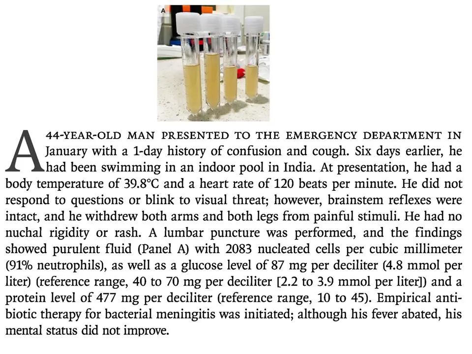 游泳得脑膜炎,游泳发烧会引起脑损伤吗