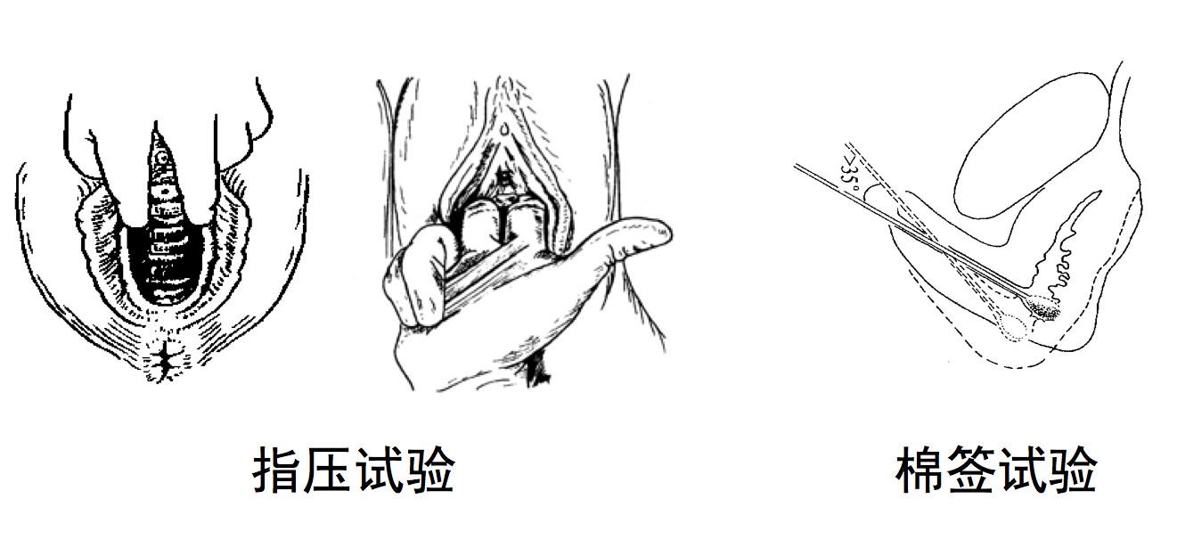 笑尿了也是一种病听听专家怎么说,笑尿了具体是什么病