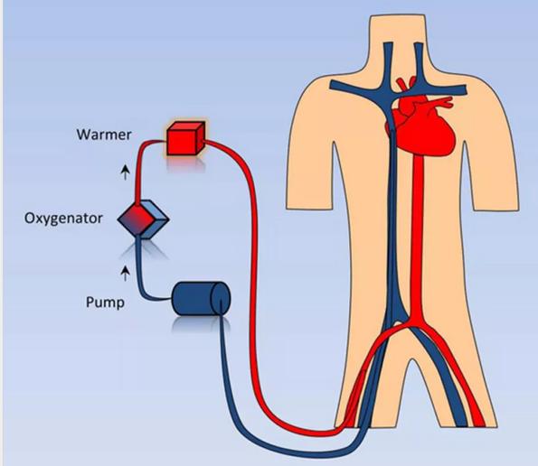 东莞这些医院有ECMO!被神化的利器背后,考量医院综合实力!
