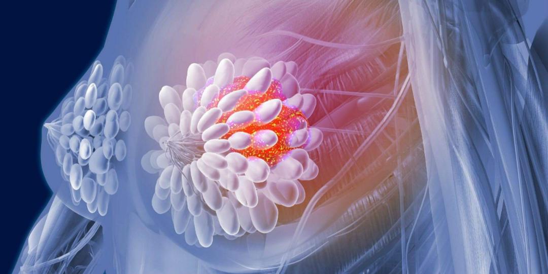 杏林宝鉴|吃大闸蟹后竟发作这个病？这种体质不宜多吃