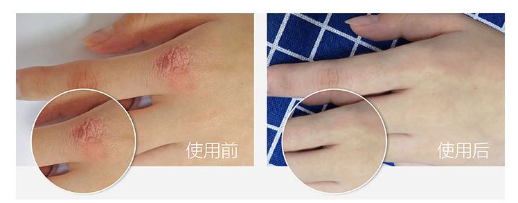 李佳琦赞不绝口的全能乳膏，一年卖出600万瓶，秋冬有它，皮肤再也不干燥