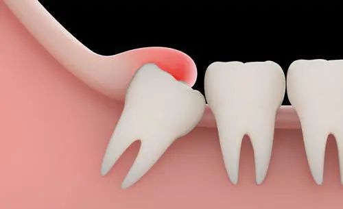 戴口罩闻不见口臭是口源性口臭么,戴上口罩口臭