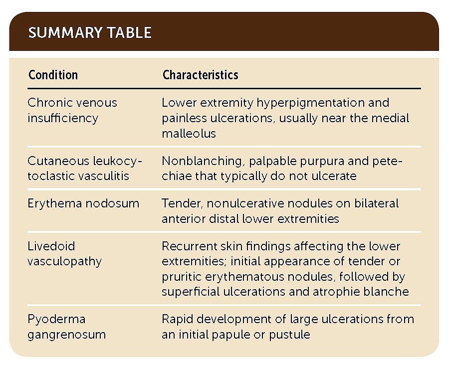 小腿处出现局部皮肤溃疡的症状,小腿下肢溃疡治疗要多久