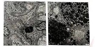 京鲁名医血液病联合会诊,北京援藏医疗队北医三院