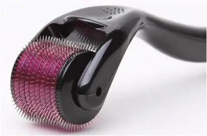 鱼尾纹去除了还长吗,鱼尾纹散开怎么回事