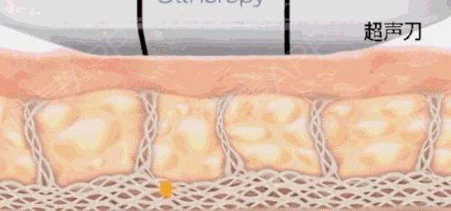 脸越来越圆胖是怎么回事,为什么腮和脸突然胖了好多