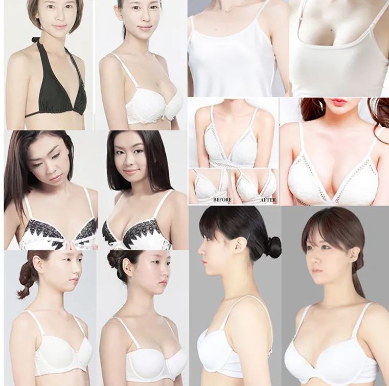 如何快速丰胸且不会反弹,不吃药怎么丰胸