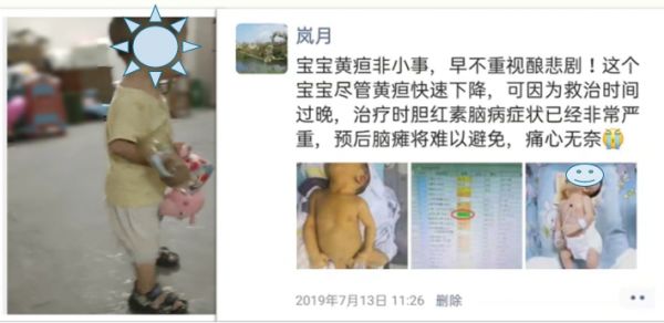 健康育儿早知道新生儿黄疸,新生宝宝病理性黄疸如何治疗