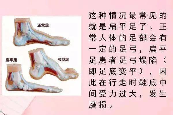 关注“跑偏”的鞋子，提示你的健康问题！