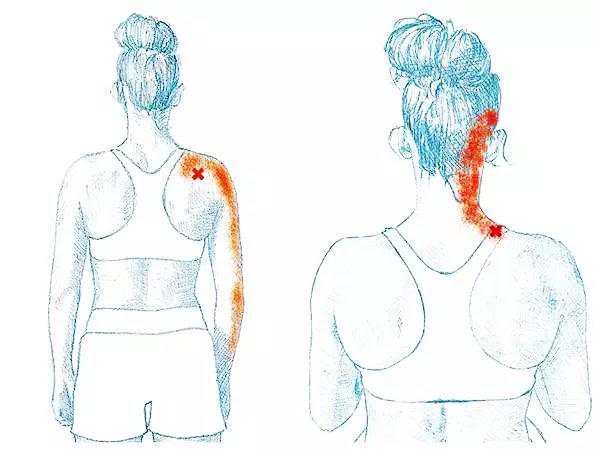 手麻是什么原因造成的怎样治疗,手麻是五种原因引起的要警惕