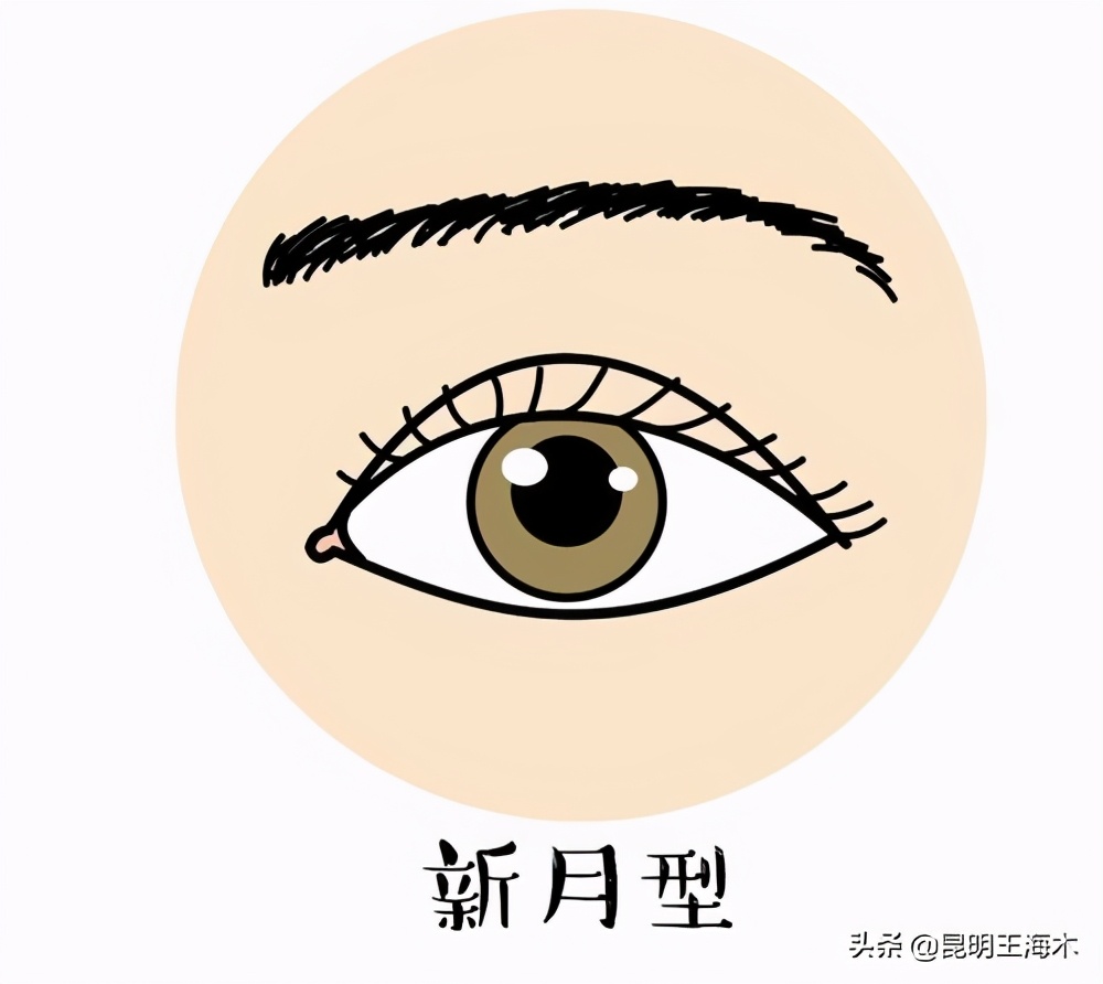 想做双眼皮先看看你适合什么方案,做双眼皮的三种方法你适合哪种