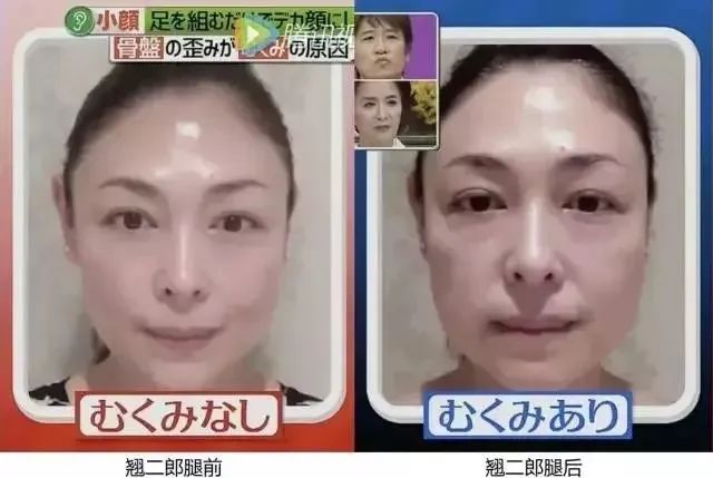 有助于脸变小的习惯,如何按摩可以让脸变好看