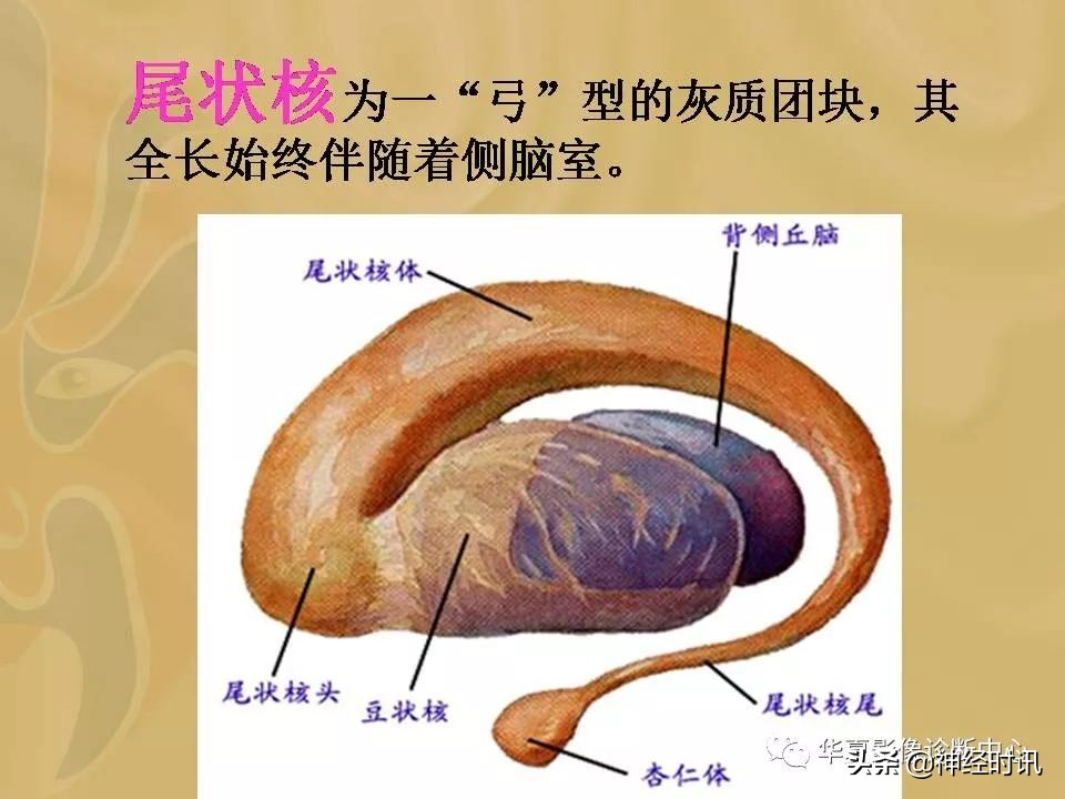 基底节ct解剖示意图,影像解剖图谱怎么用