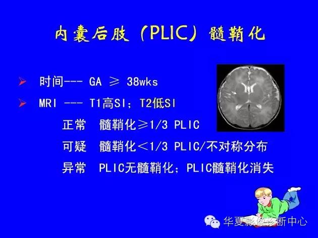 新生儿颅脑mri,新生儿颅脑mr报告模板