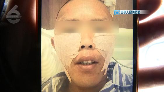 张嘴会响左右不对称!30岁小伙花三万“去颧骨”失败找院方协商还想再做手术