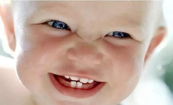 孩子牙齿很久未长出需要干预吗,小孩子牙齿不往外长
