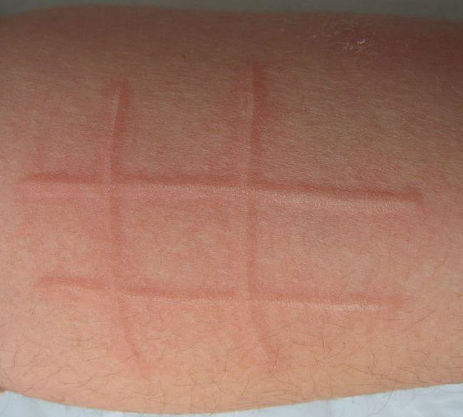 免疫病和免疫系统疾病一样么,常见的免疫疾病有哪些