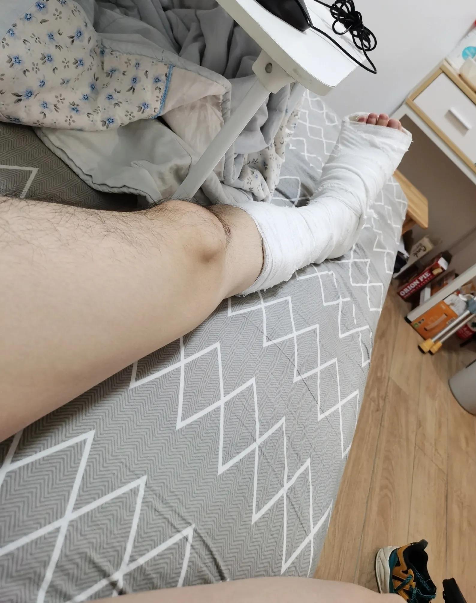 第五跖骨基底部骨折60天能走路吗,第五跖骨基底部骨折60天能脱拐吗