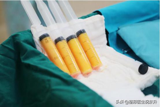 各种除皱方式你选对了吗,最权威最有效的除皱产品