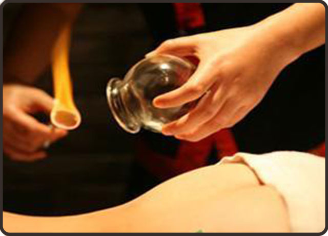 拔火罐注意事项和禁忌,高血压拔火罐注意事项