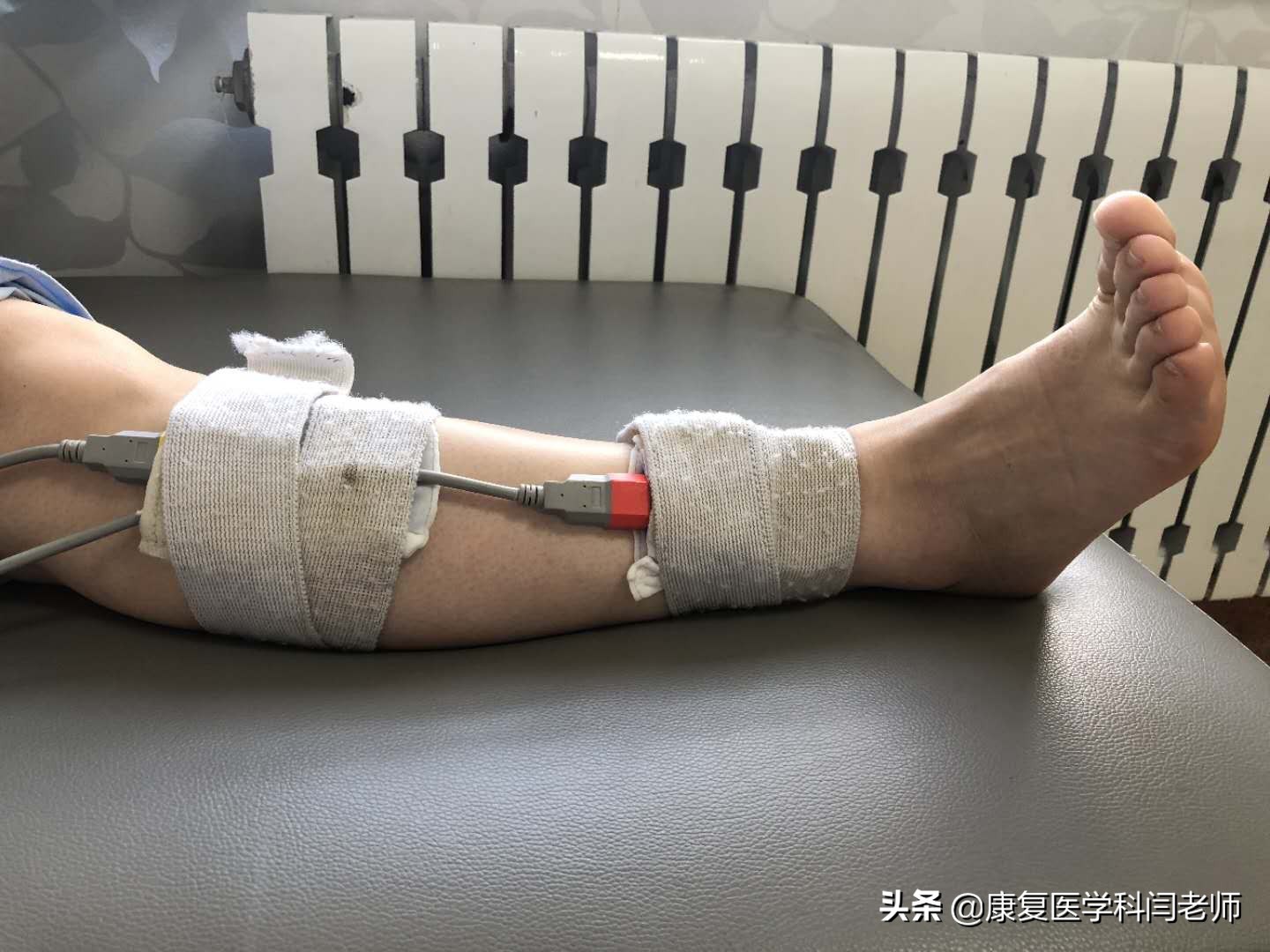 中频康复治疗,康复科中频脉冲治疗