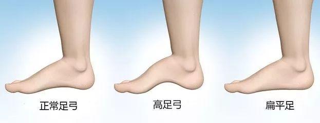 膝盖无力，前侧疼痛、甚至出现爆裂声？你的膝盖到底怎么了？