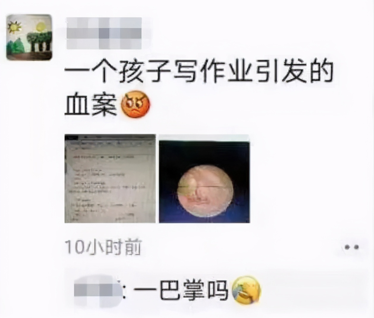 小孩儿声音吼哑了怎么办,儿童听力障碍的表现及训练方法